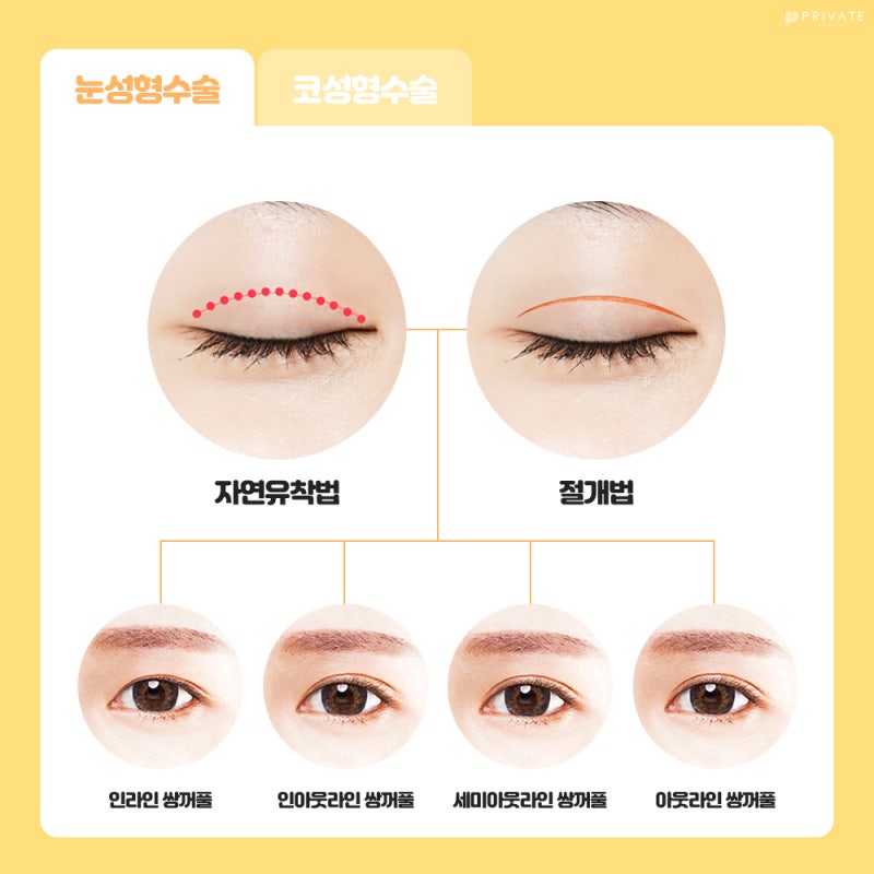 Acara Ujian Masuk Perguruan Tinggi, Private Plastic Surgery 사진 4