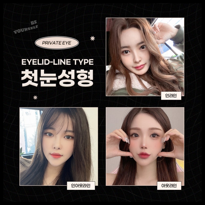 첫눈성형수술은 신사역 프라이빗성형외과 사진 5