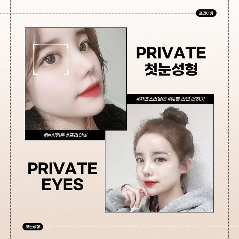 첫눈성형수술은 신사역 프라이빗성형외과 사진 6