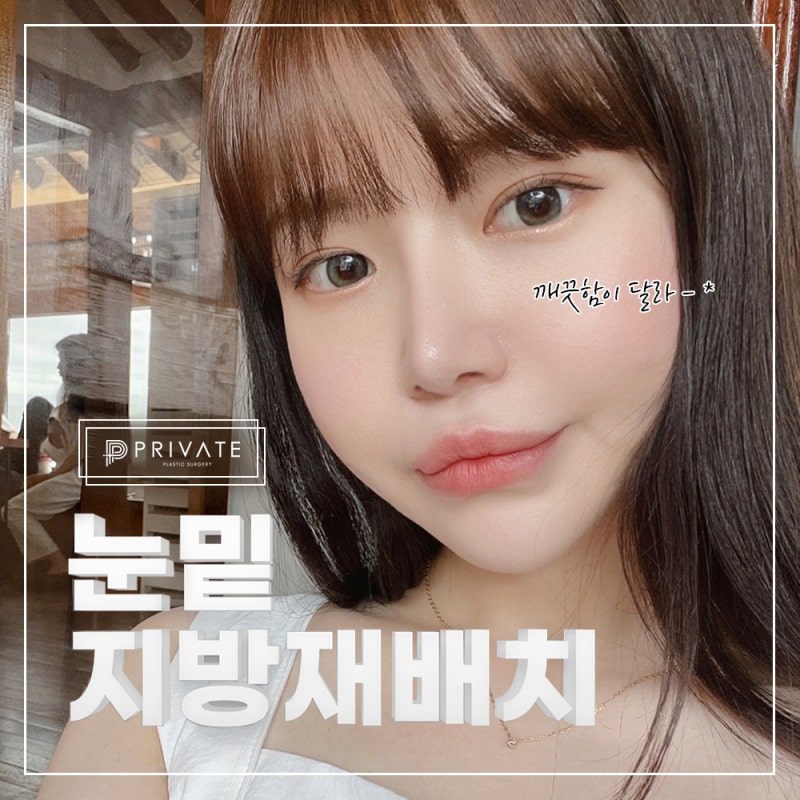 Ulasan Bagus untuk Operasi Kantung Mata di Sinsa Private Plastic Surgery 사진 2