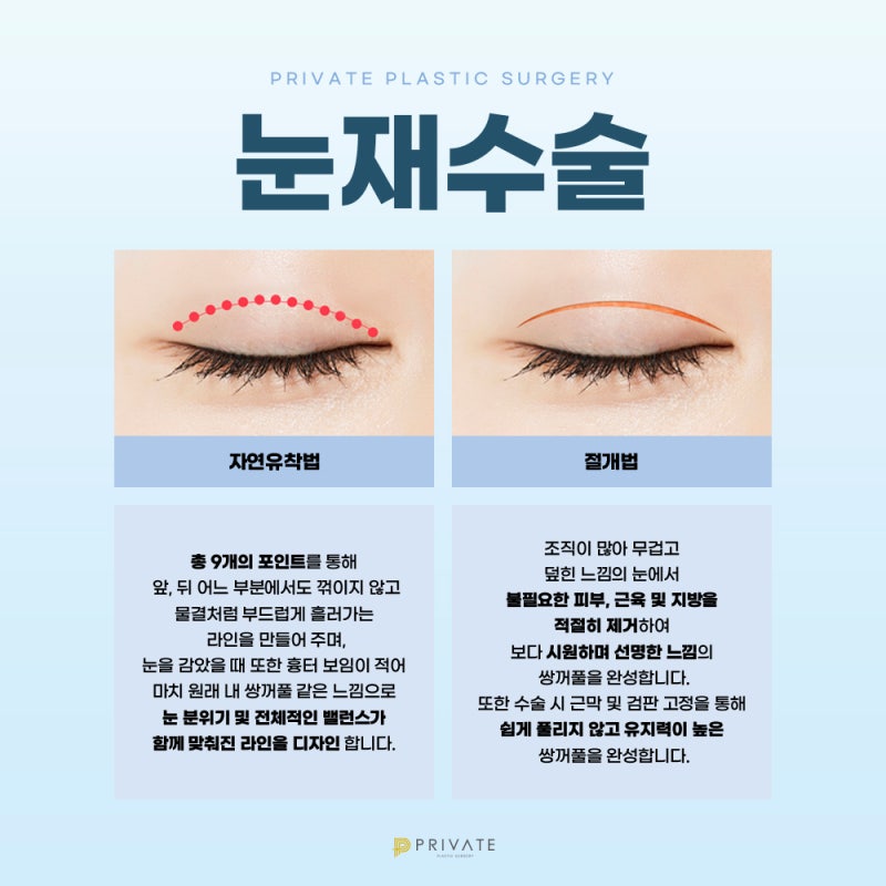 Ulasan Bagus Operasi Revisi Penyatuan Alami di Private Plastic Surgery 사진 4