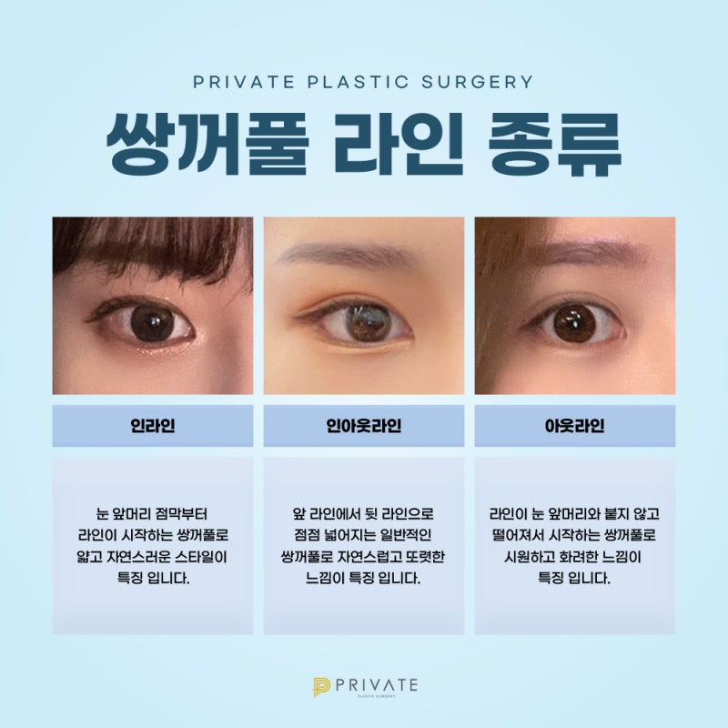 Ulasan Bagus Operasi Revisi Penyatuan Alami di Private Plastic Surgery 사진 5