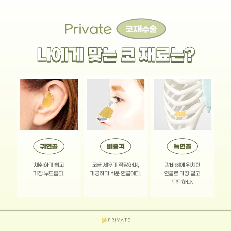코 재수술 병원 후기, 프라이빗에서 확인해 사진 4