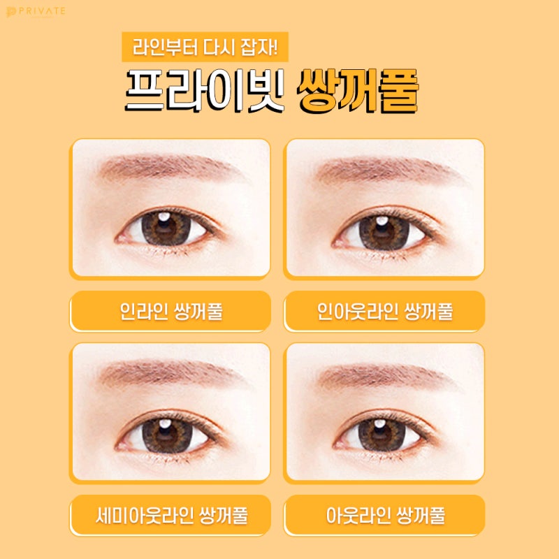 자연유착쌍꺼풀후기는 프라이빗성형외과 사진 4