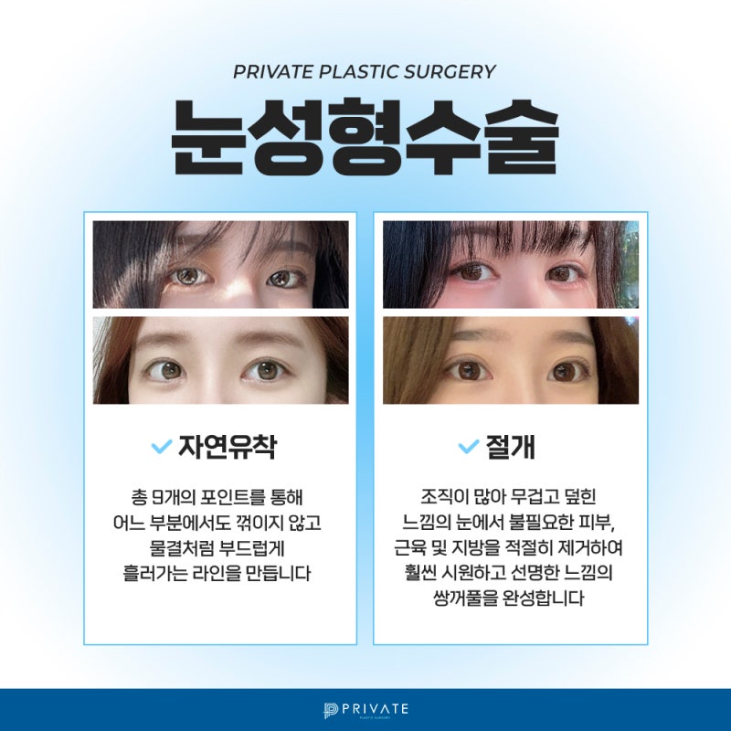 Let's explore natural adhesion double eyelid surgery at Sinsa Private Plastic Surgery Clinic 사진 4