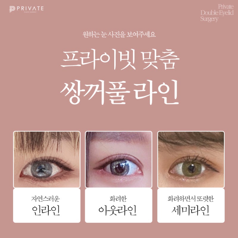 Check out Incision Double Eyelid Surgery Reviews at Sinsa Private Plastic Surgery Clinic 사진 4