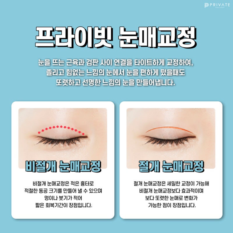 눈매교정수술전후가 좋은 프라이빗성형외과