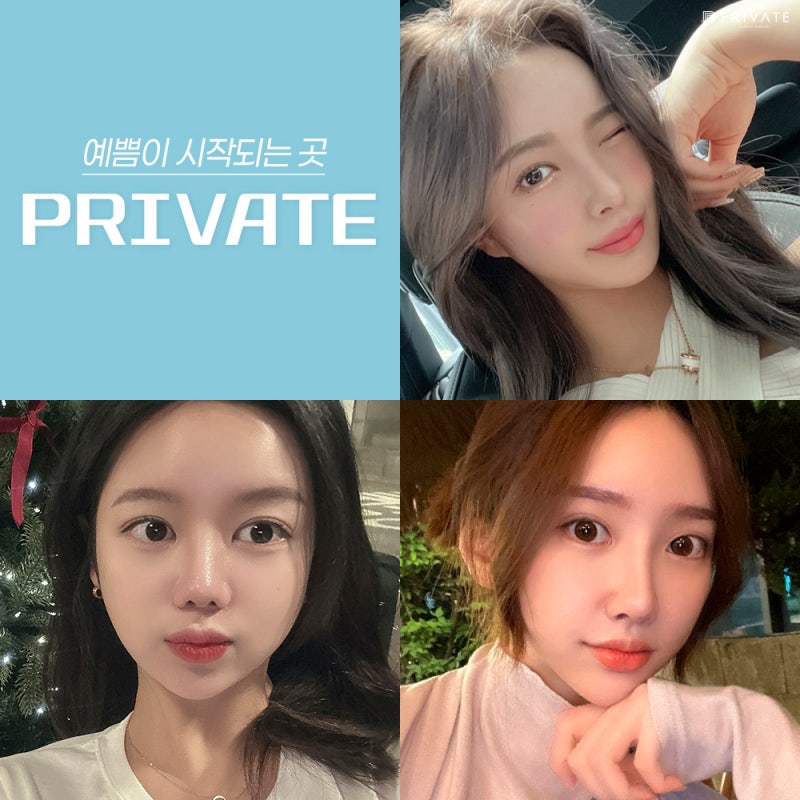눈매교정수술전후가 좋은 프라이빗성형외과 사진 7