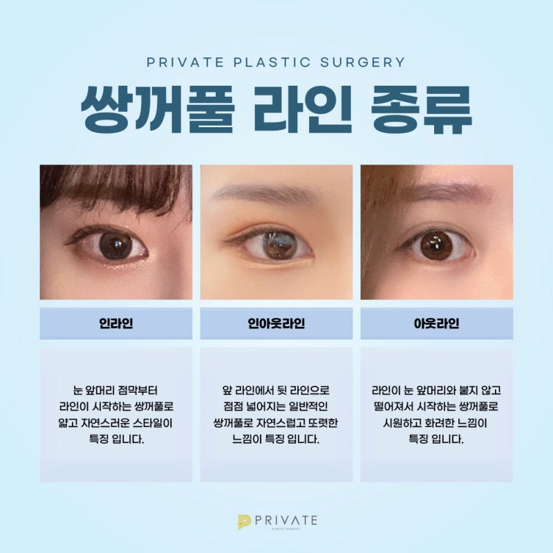 눈재수술잘하는곳 신사 프라이빗성형외과 사진 5