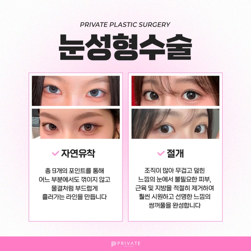 프라이빗 성형외과 쌍수 알아보자