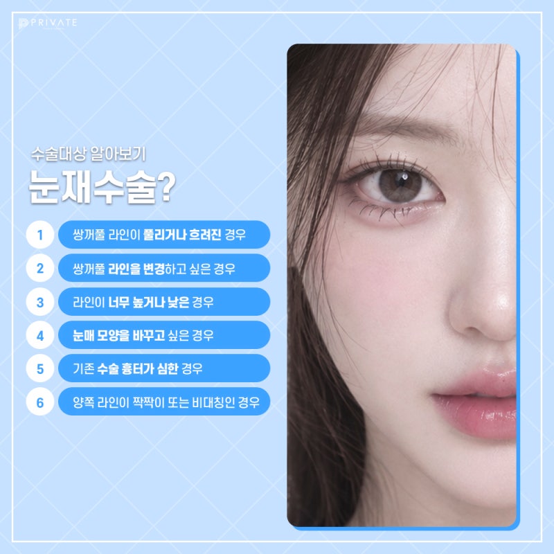 프라이빗 성형외과 눈 재수술 알아보자 사진 5